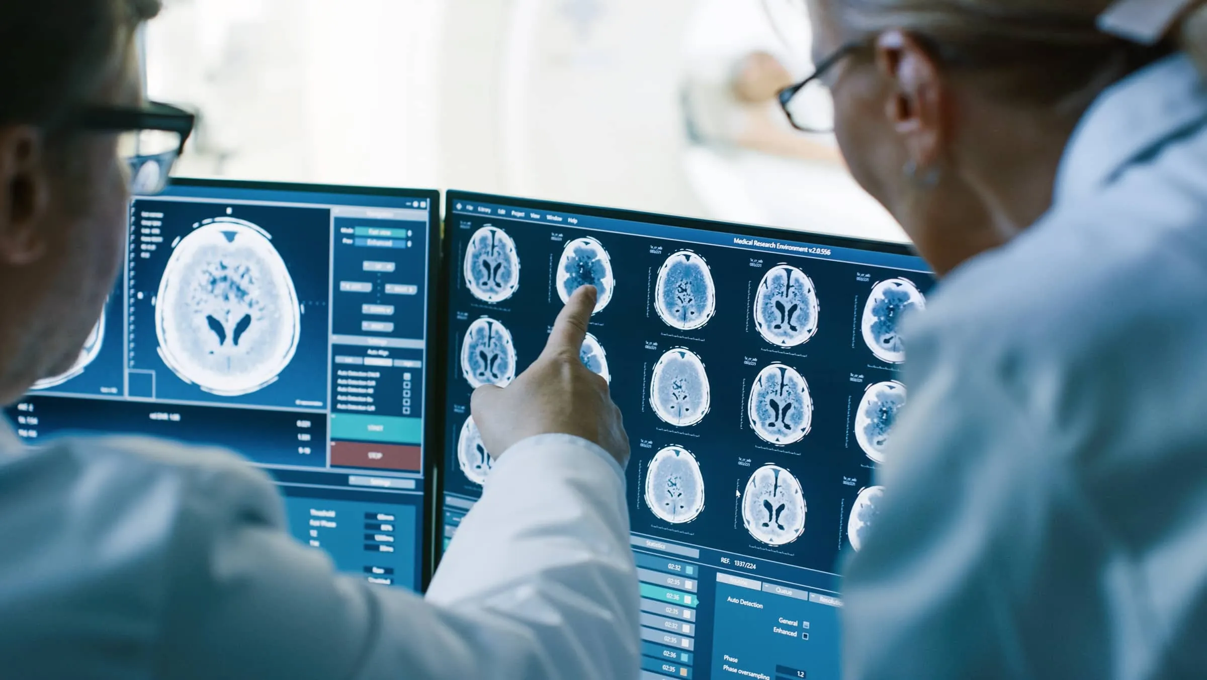 Doctor and radiologist discuss diagnosis while watching procedure and monitors showing brain scans results.